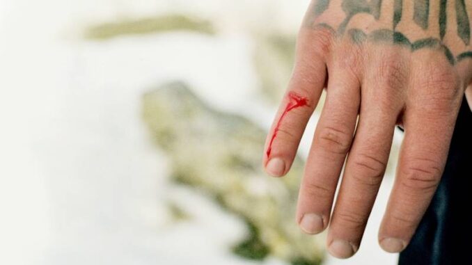 Blanco - Anche a vent’anni si muore